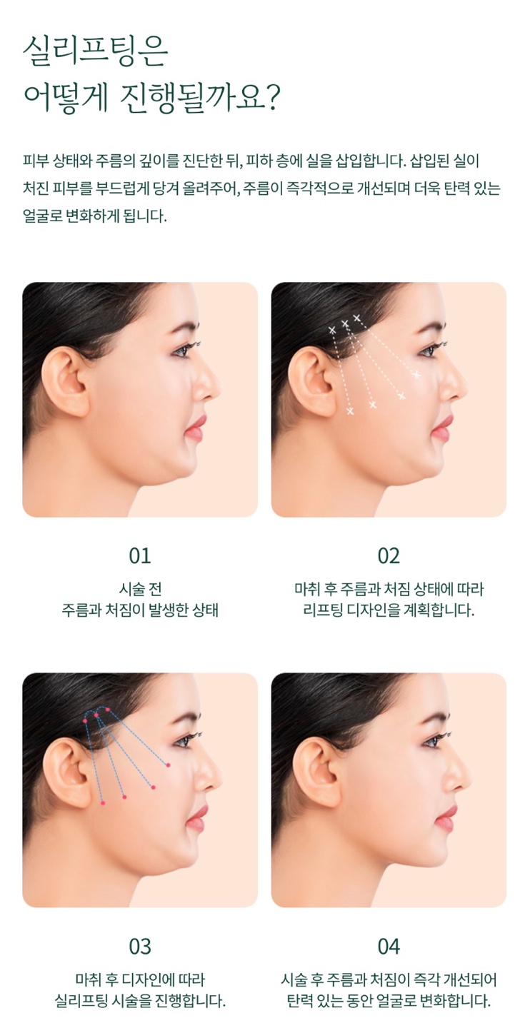 여의도성형외과 실리프팅에 대하여 관련 이미지 9