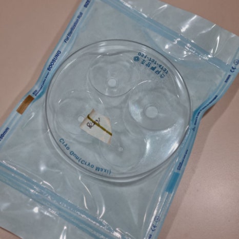 Cryotherapy Review for Finger Warts and a Video of the Actual Treatment Process Included image 10
