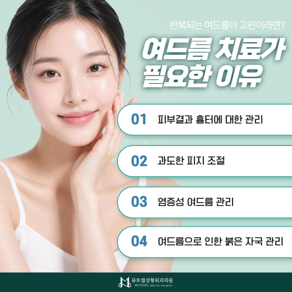 여드름 치료, 먹는 약부터 압출·포텐자·레이저까지 알아보기 관련 이미지 2