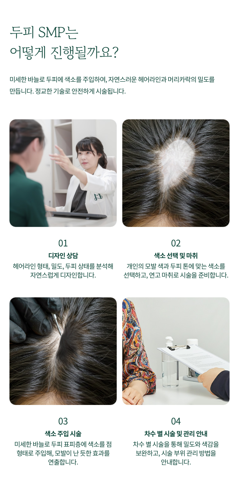 Natural Coverage with Scalp SMP image 3