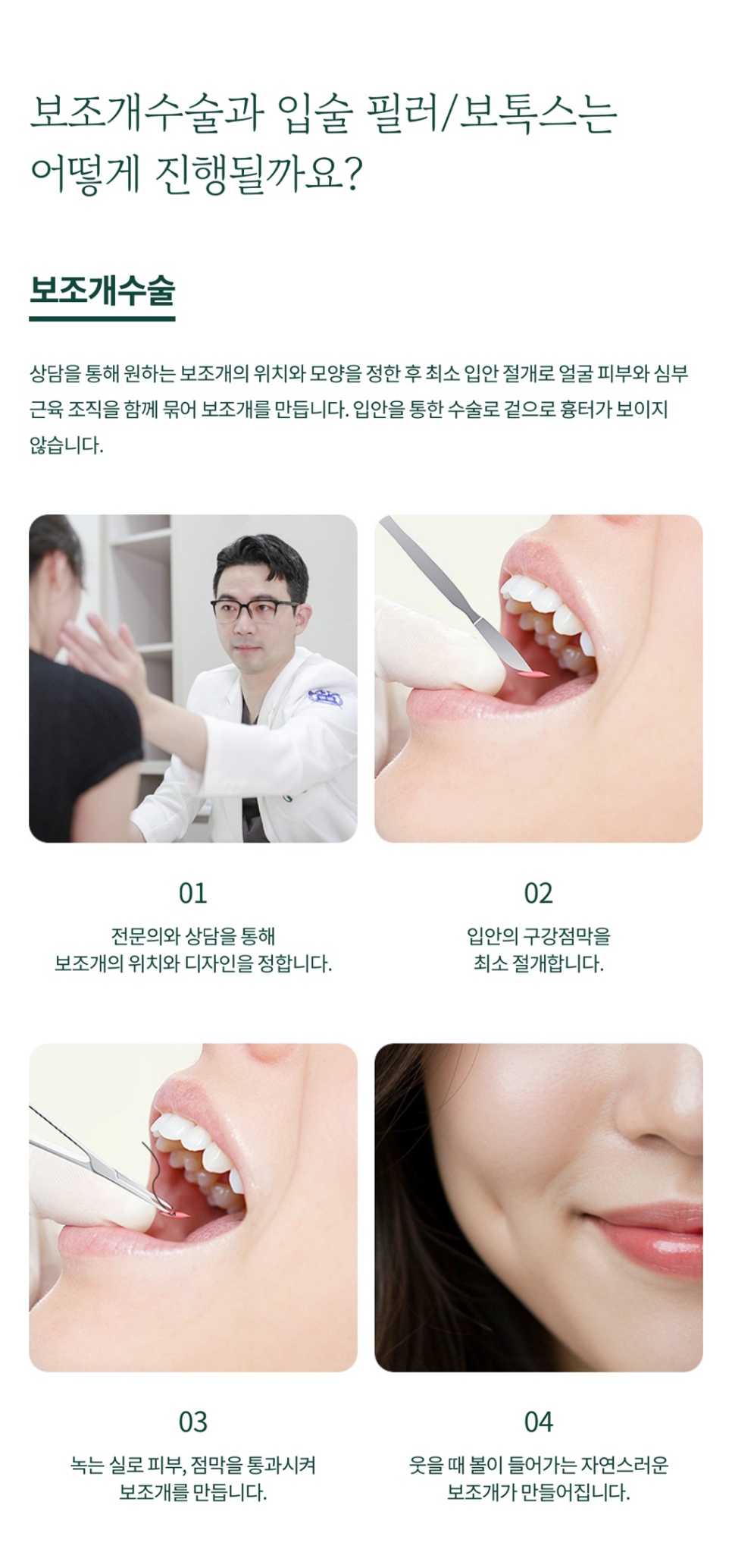 Refining Expression With Dimple Surgery at Sinyongsan Plastic Surgery image 6