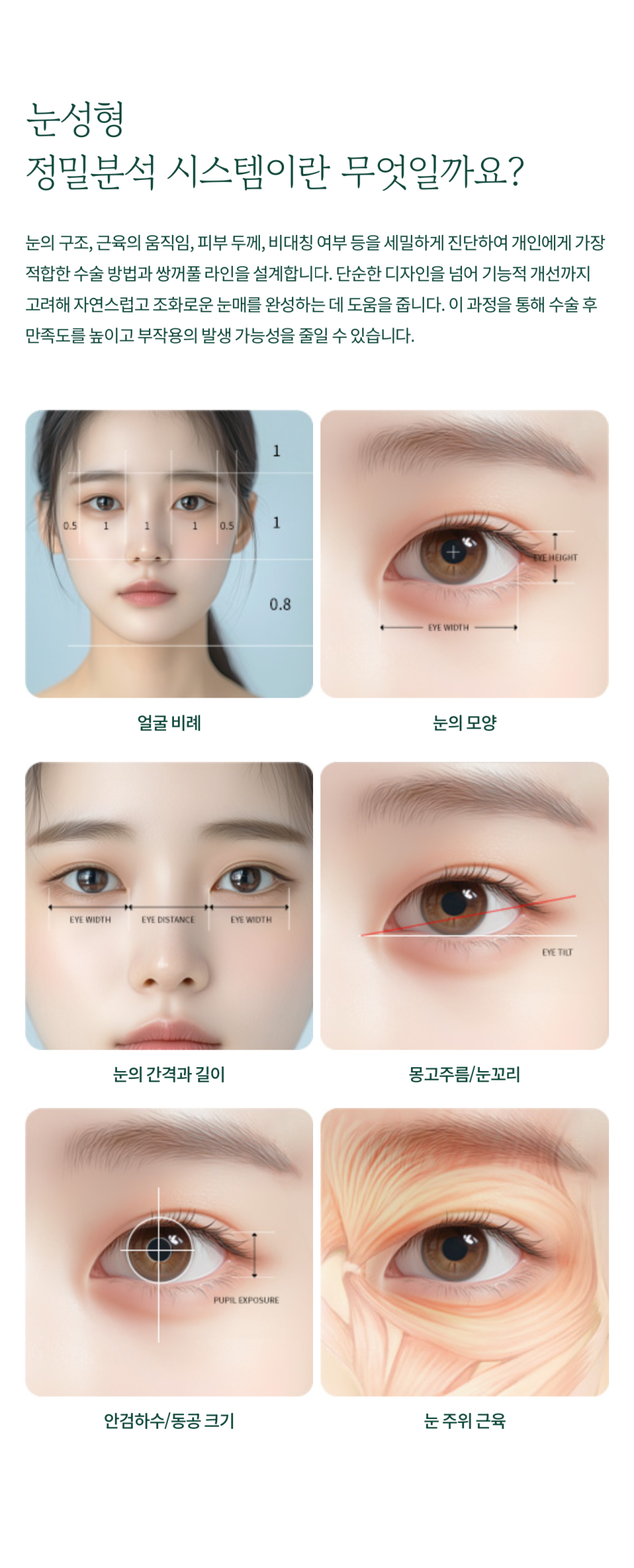 Subincisional Double Eyelid Surgery with Precise Technique at Sin-Yongsan Plastic Surgery image 5