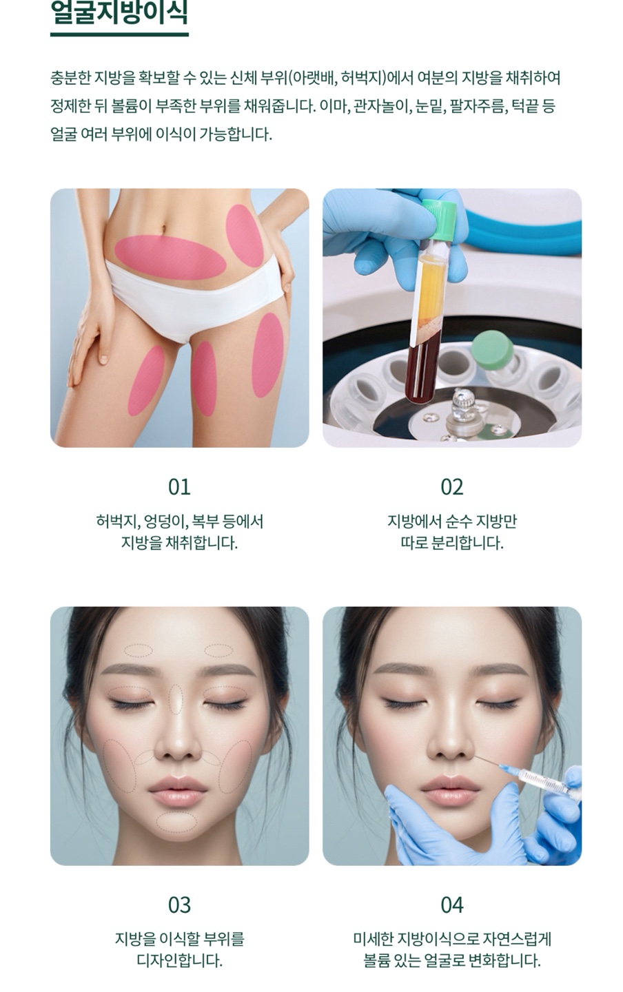 미니거상 수술 피부의 탄력을 더하기 위해 관련 이미지 6