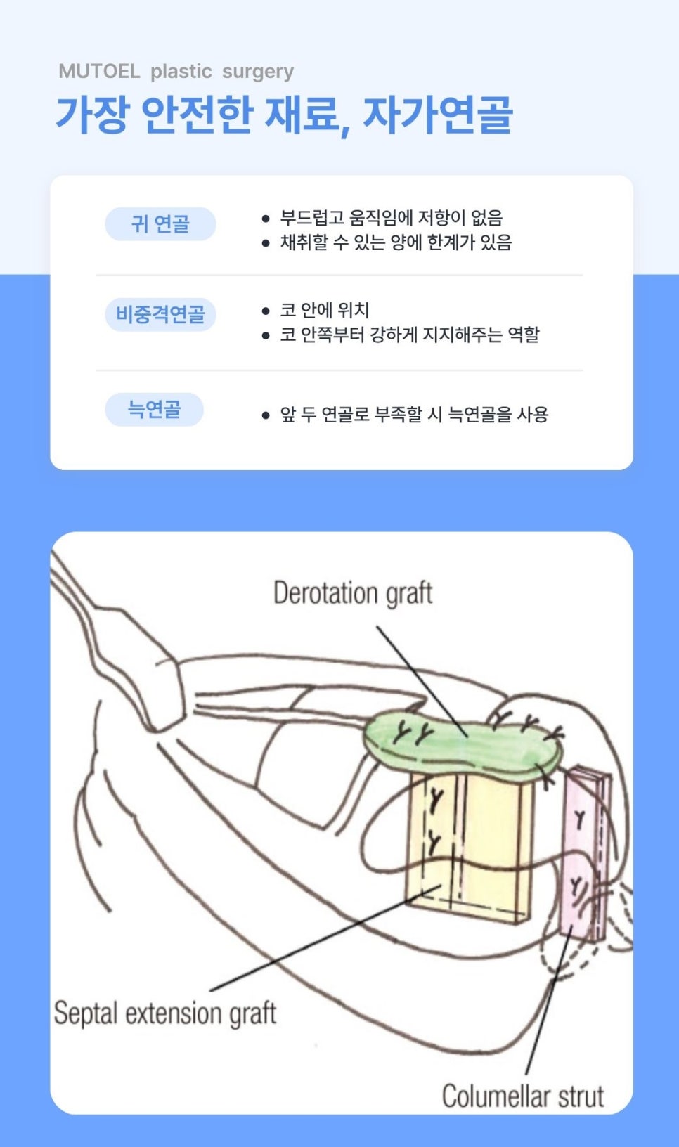 코 성형의 막연한 공포를 확신으로 바꾸는 안전한 수술의 조건 관련 이미지 4