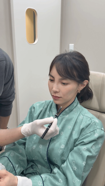 Types of Hollow Cheek Treatments and Restoring Volume with Radiesse image 11