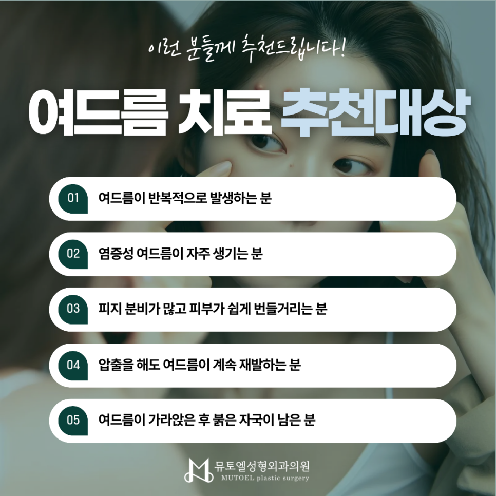 여드름 치료, 먹는 약부터 압출·포텐자·레이저까지 알아보기 관련 이미지 6