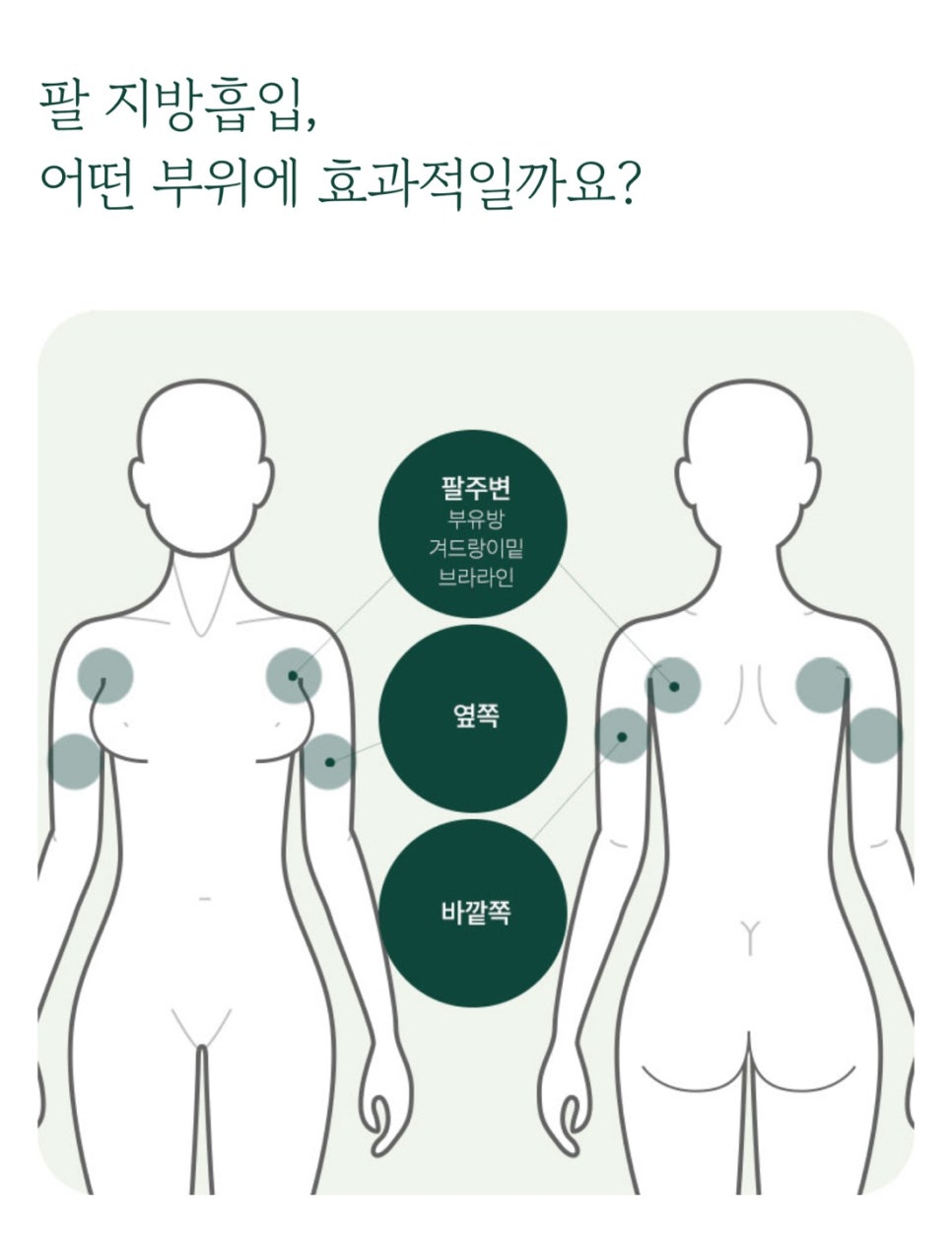 Yeouido Plastic Surgery Clinic: Achieve a Tidy Body Line with Arm Liposuction image 4