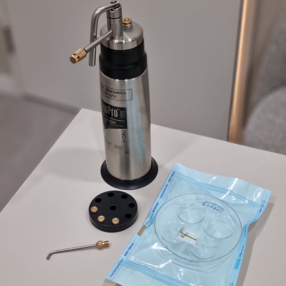 Cryotherapy Review for Finger Warts and a Video of the Actual Treatment Process Included image 17