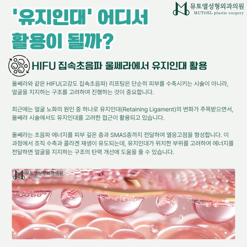 얼굴 처짐의 핵심 관련 이미지 4