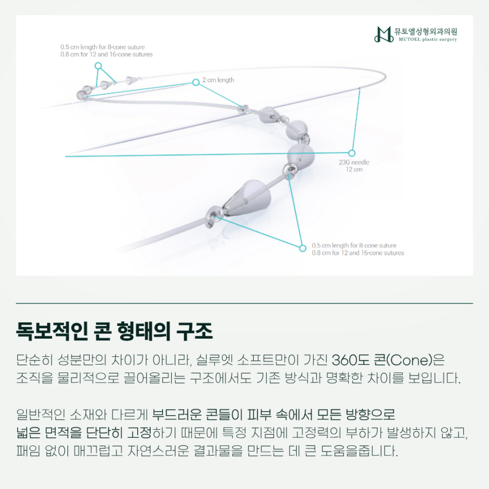 Silhouette Soft: A Specialist’s Review and Information After Personally Performing the Procedure on Family Members image 3