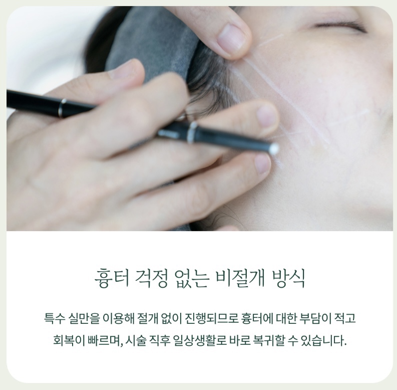 여의도성형외과 실리프팅에 대하여 관련 이미지 6