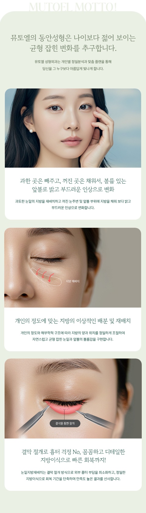 Bright and Youthful with Under-Eye Fat Repositioning and Fat Grafting image 4
