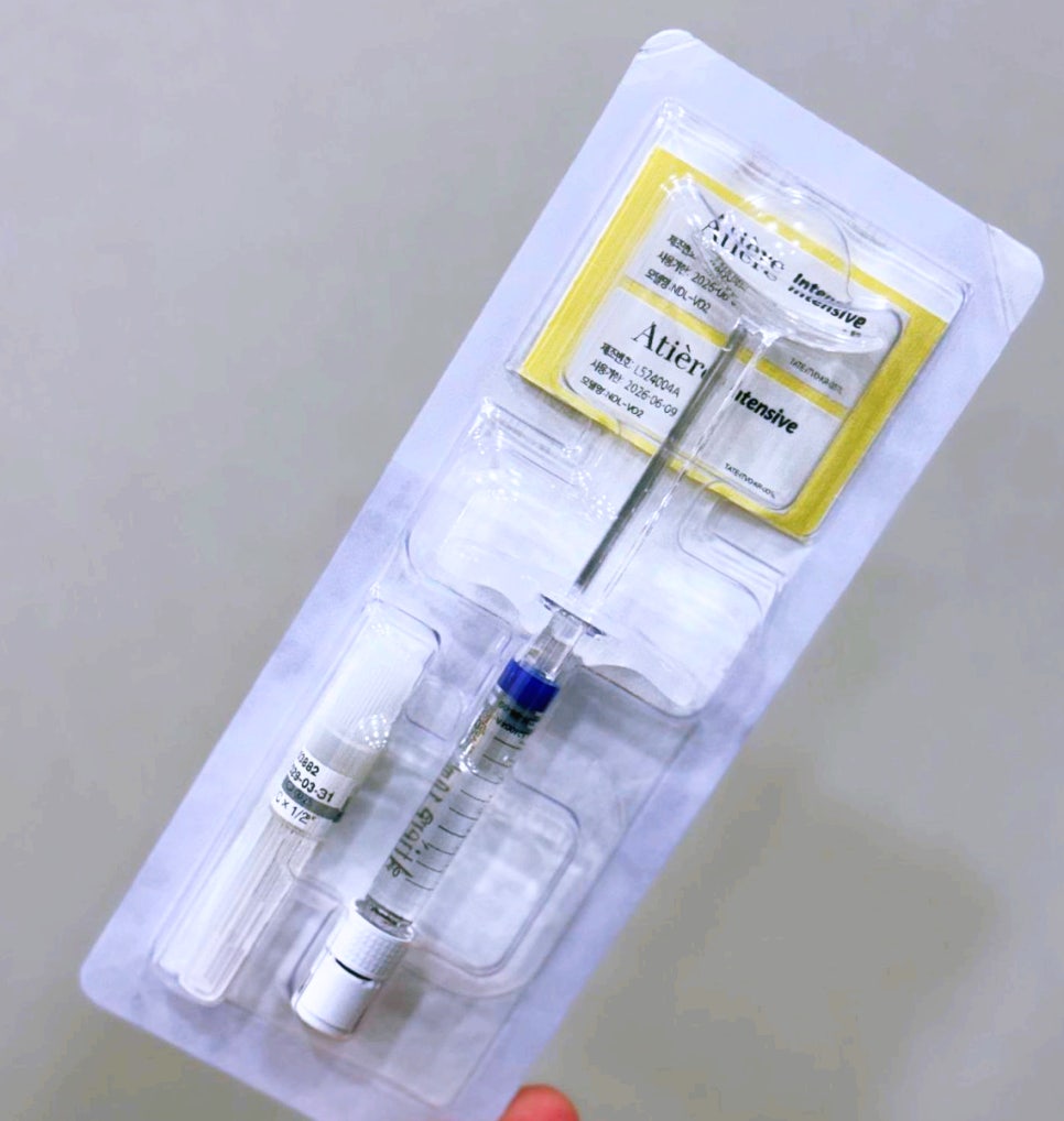 Types of Hollow Cheek Treatments and Restoring Volume with Radiesse image 2