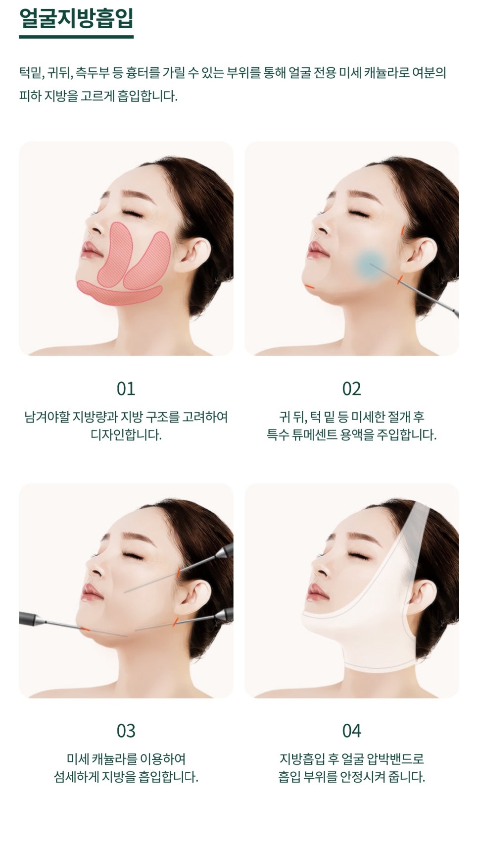 미니거상 수술 피부의 탄력을 더하기 위해 관련 이미지 7