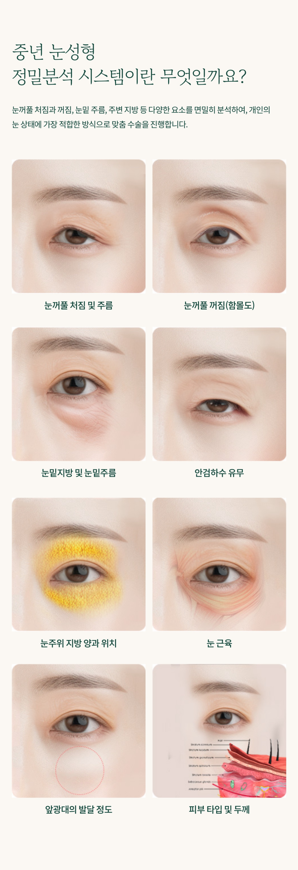 하안검수술 부작용 걱정 없이 젊음을 되찾고 싶다면 관련 이미지 5