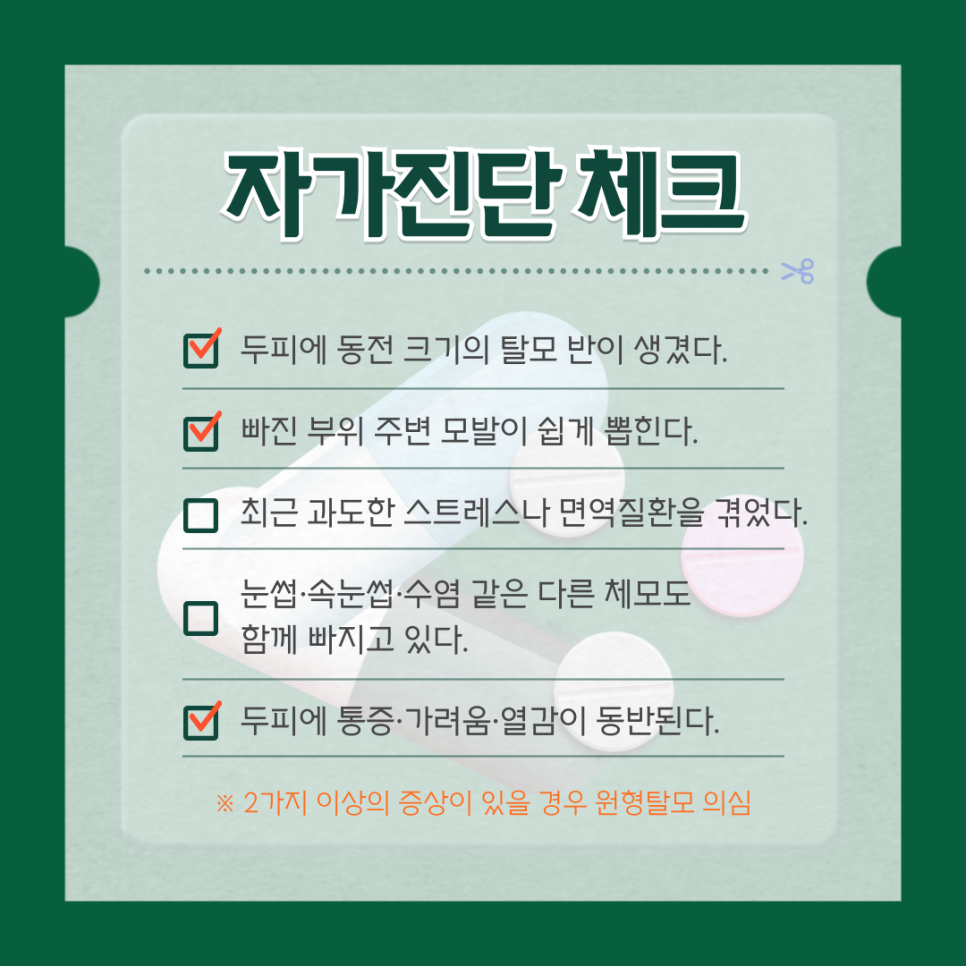 원형 탈모, 국소 스테로이드 주사로 근본적 해결을 관련 이미지 4