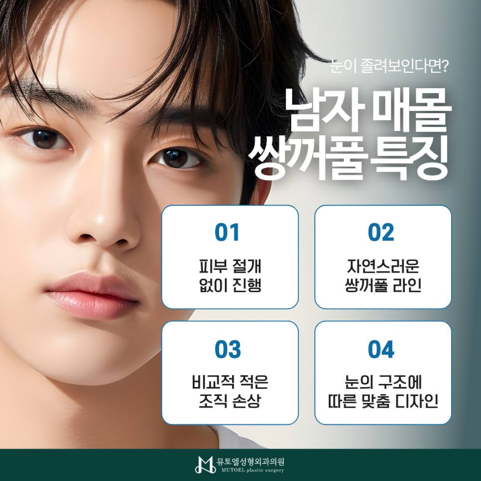 남자 눈 성형이 고민이라면? 매몰 쌍꺼풀·눈매교정술 관련 이미지 2