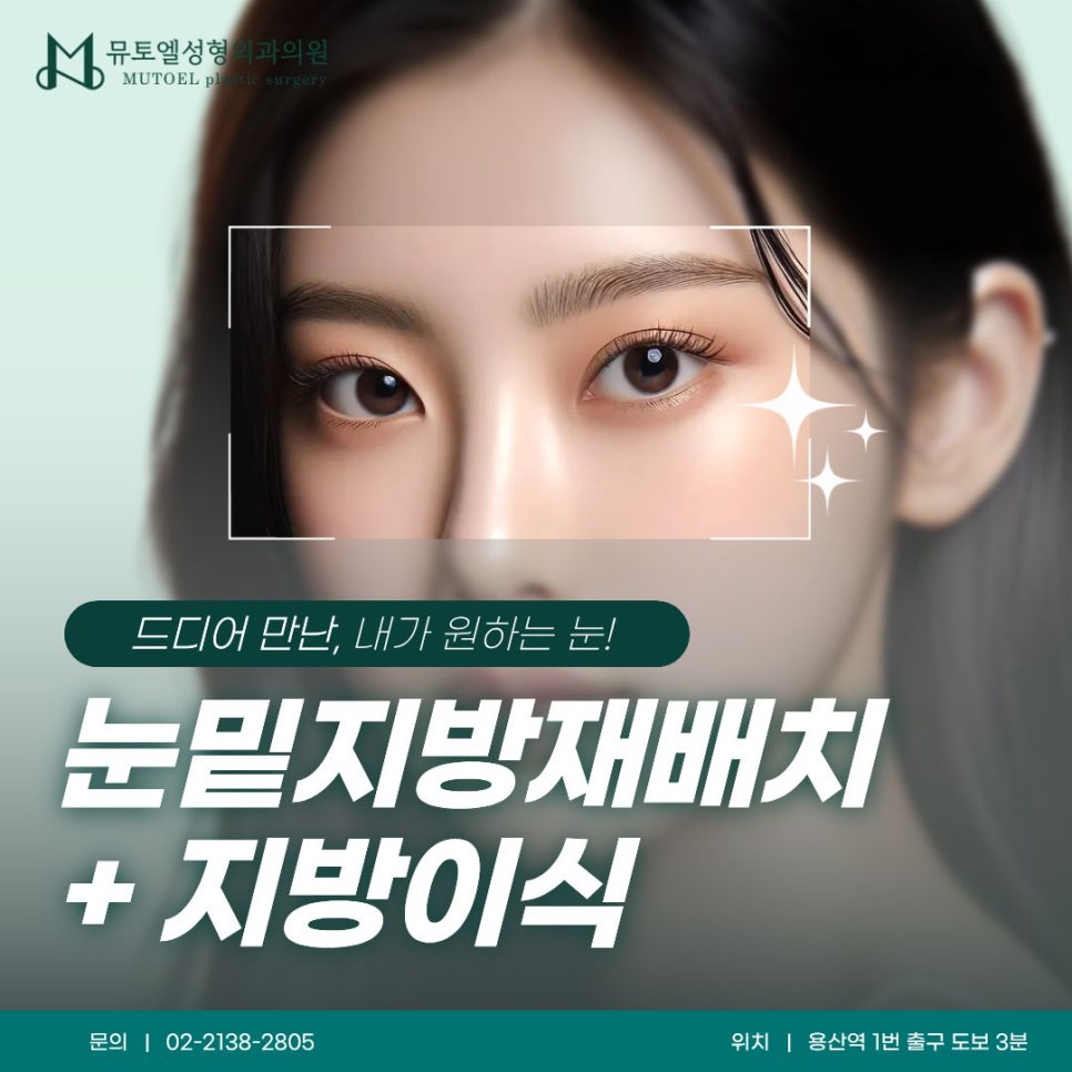 눈밑지방재배치 + 지방이식, 함께 필요한 경우는? 관련 이미지 1