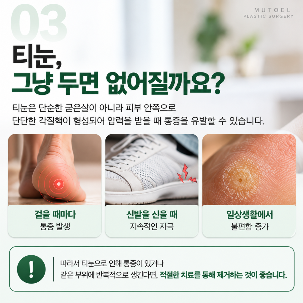 손, 발에 생긴 티눈 냉동치료로 제거할 수 있을까? 보험 적용까지 알아보기 관련 이미지 3