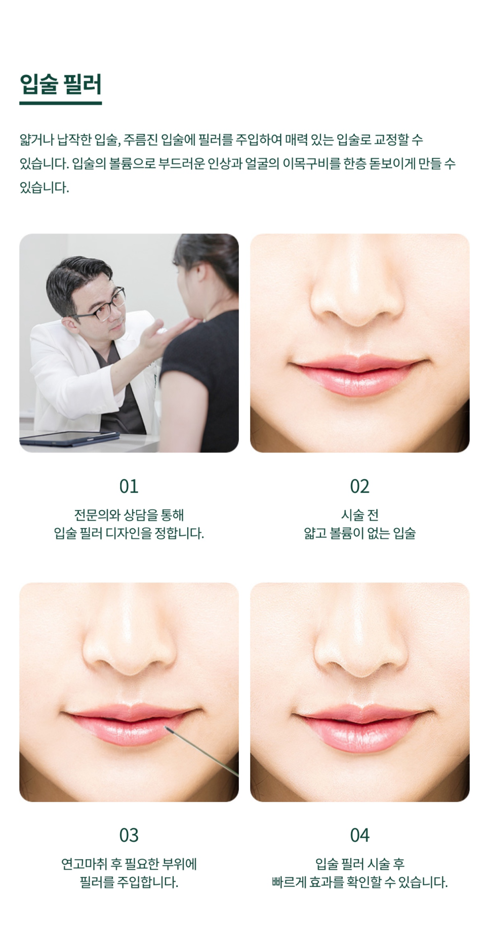 Refining Expression With Dimple Surgery at Sinyongsan Plastic Surgery image 8