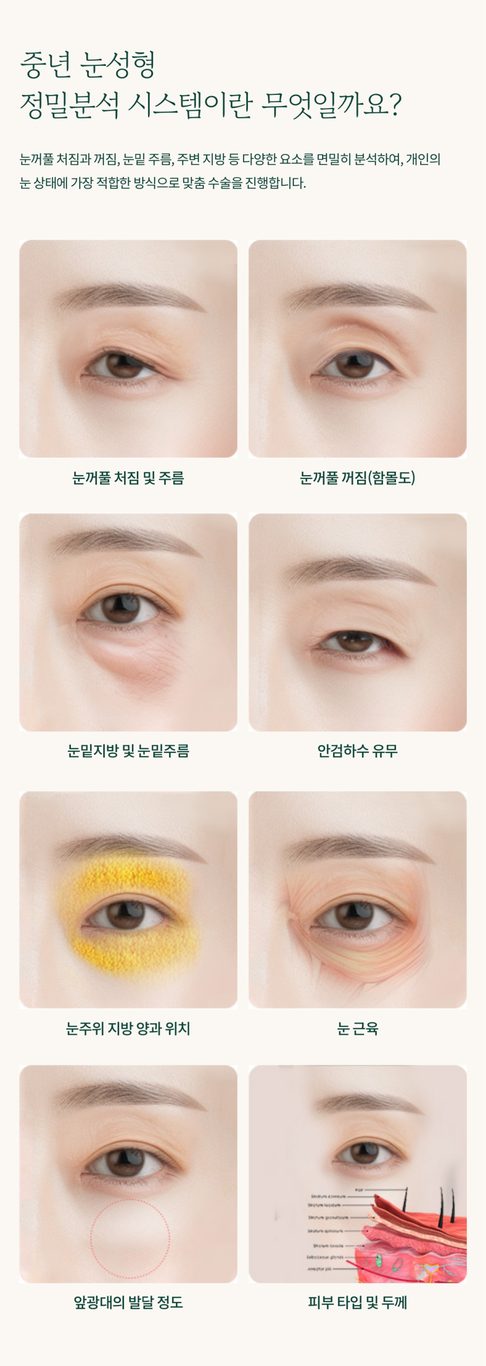 For Sharpening a Sagging Eye Shape with Brow Lift Surgery image 5