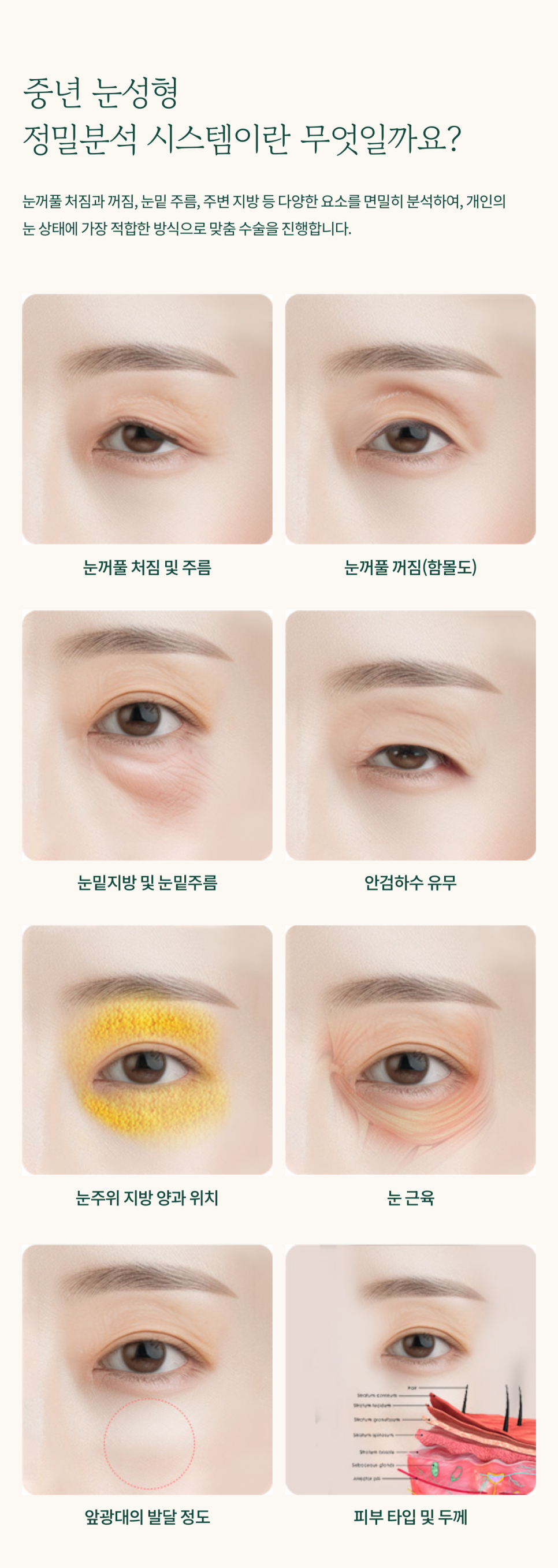 Improving the Under-Eye Area to Make the Eyes Look Younger at Sinyongsan Plastic Surgery image 6