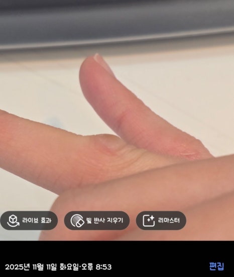 Cryotherapy Review for Finger Warts and a Video of the Actual Treatment Process Included image 16