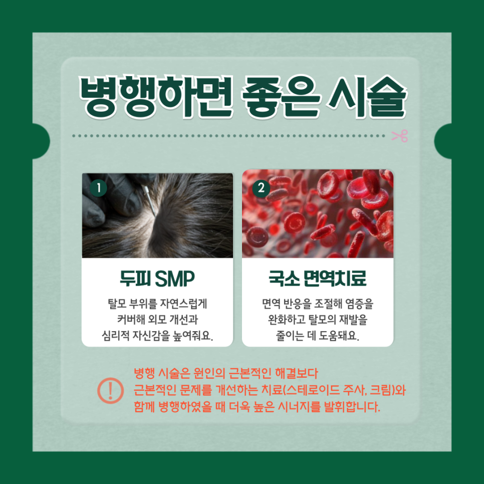 원형 탈모, 국소 스테로이드 주사로 근본적 해결을 관련 이미지 5