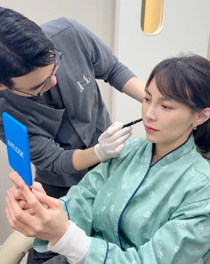 Types of Hollow Cheek Treatments and Restoring Volume with Radiesse image 10