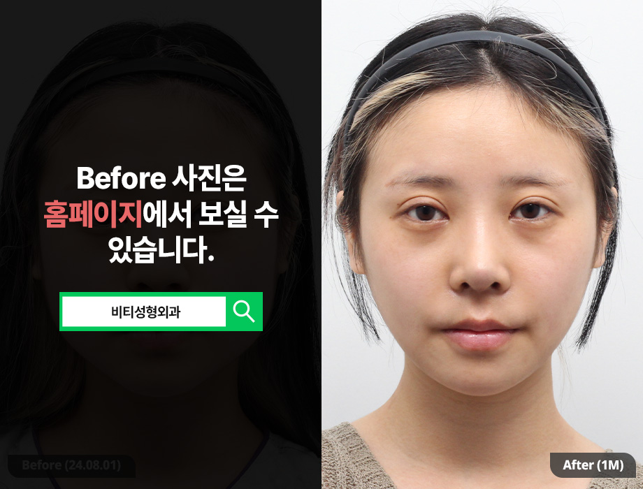 Why Influencers Get Plastic Surgery | Facial Contouring Edition | How to Look Good on Camera✨ image 1