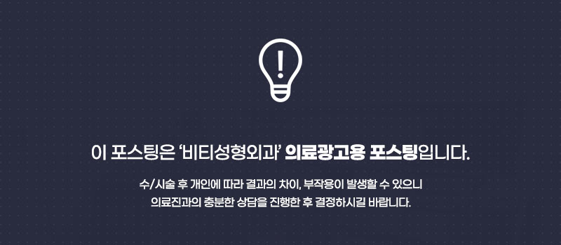 윤곽 수술 종류별 효과와 회복 기간까지 정리! 관련 이미지 11