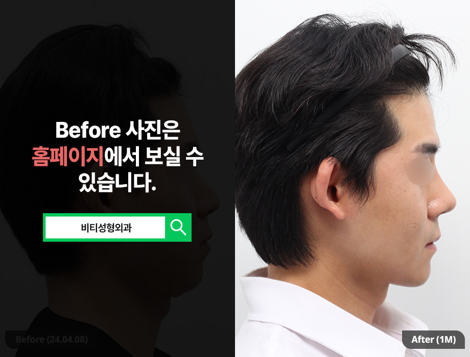What You Should Check If You’re Considering Male Facial Contouring Surgery image 3