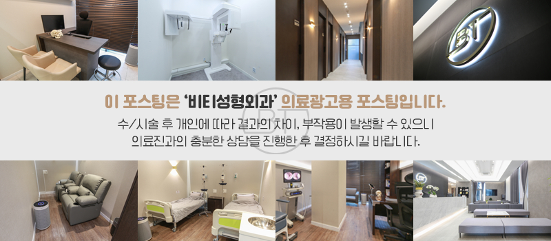 귀연골로 복코 교정 가능한가요? + 코 필러 제거 관련 이미지 12