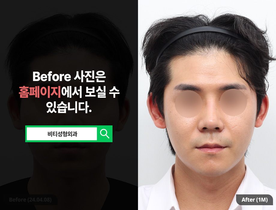 What You Should Check If You’re Considering Male Facial Contouring Surgery image 1