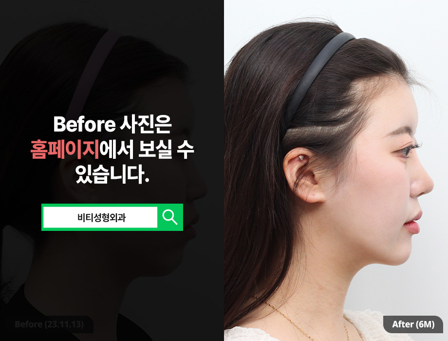얼굴이 길어 보인다면? 중안부 짧아보이게 만드는 윤곽 3종 효과 관련 이미지 3