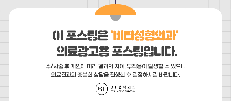 얼굴이 작은데 윤곽수술 해도 되나요? 작고 각진 얼굴 9개월 후기 관련 이미지 12