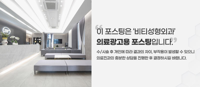 무보형물 코성형 장단점을 확실히 알아보고 관련 이미지 12