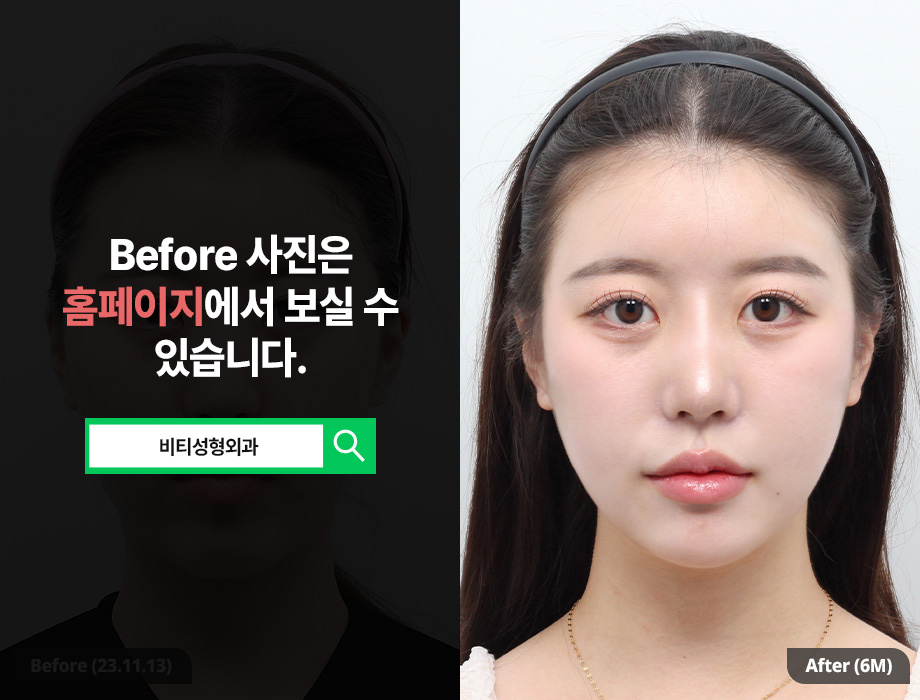 얼굴이 길어 보인다면? 중안부 짧아보이게 만드는 윤곽 3종 효과 관련 이미지 1