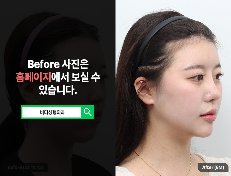 얼굴이 길어 보인다면? 중안부 짧아보이게 만드는 윤곽 3종 효과 관련 이미지 2