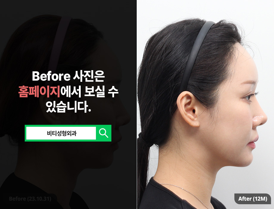 If You’re Worried About a Flat, Wide Face: A Must-Read on Face Shape Trends image 3