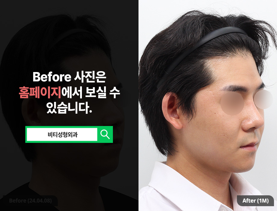 What You Should Check If You’re Considering Male Facial Contouring Surgery image 2