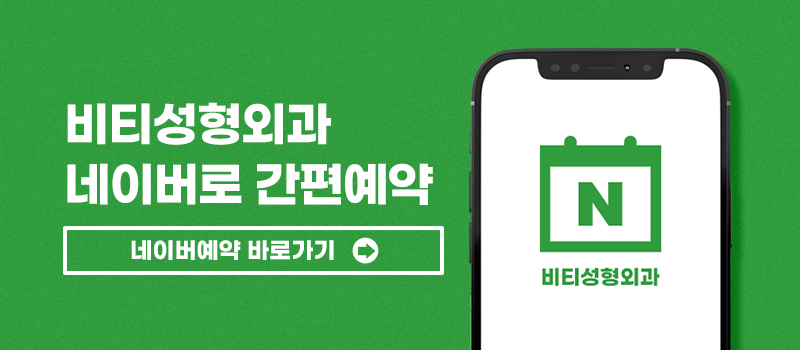 얼굴이 작은데 윤곽수술 해도 되나요? 작고 각진 얼굴 9개월 후기 관련 이미지 10