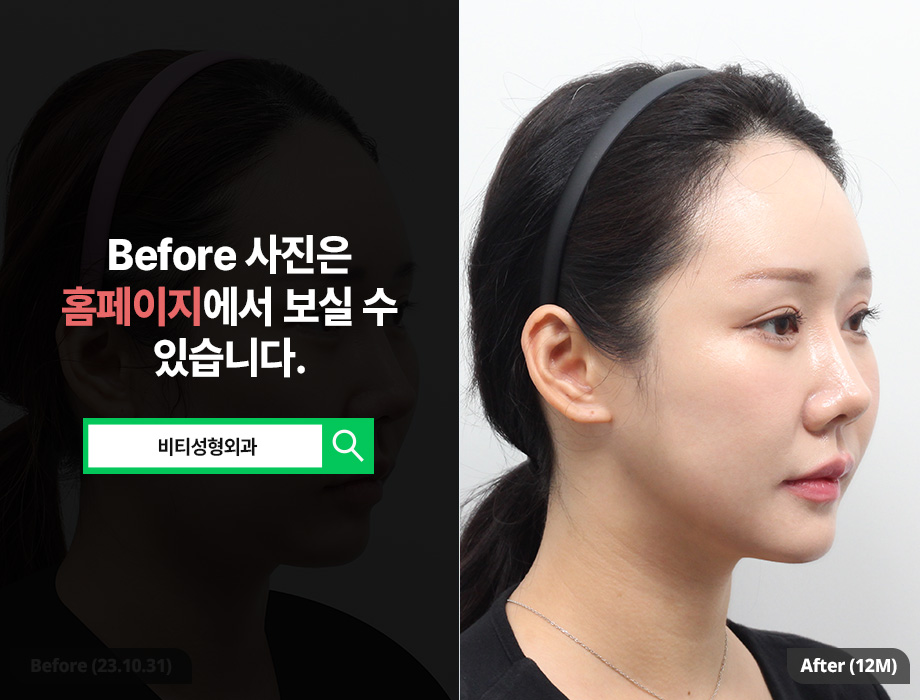 If You’re Worried About a Flat, Wide Face: A Must-Read on Face Shape Trends image 2