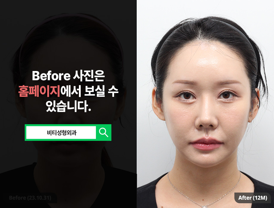 If You’re Worried About a Flat, Wide Face: A Must-Read on Face Shape Trends image 1