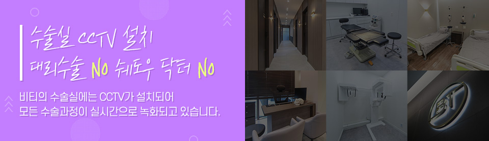 코재수술, 기능과 디자인 한번에! 기능미용코 4개월 찐후기 관련 이미지 6
