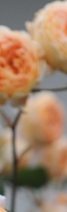 삼성역필러, 목주름, 숨기고만 싶으셨나요?간단한 시술로 자신감 UP하는 방법 관련 이미지 16