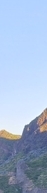 Gangnam Dermatology Clinic Hair Removal: How to Move Away from Irritating Self-Hair Removal | Laser Hair Removal image 13