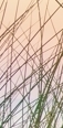 강남침샘보톡스, 무거운 얼굴선, 침샘비대증 의심된다면? 관련 이미지 8