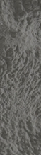 강남아이써마지, 가장 먼저 노화가 나타나는 눈가 어떻게 관리할까요? 관련 이미지 17