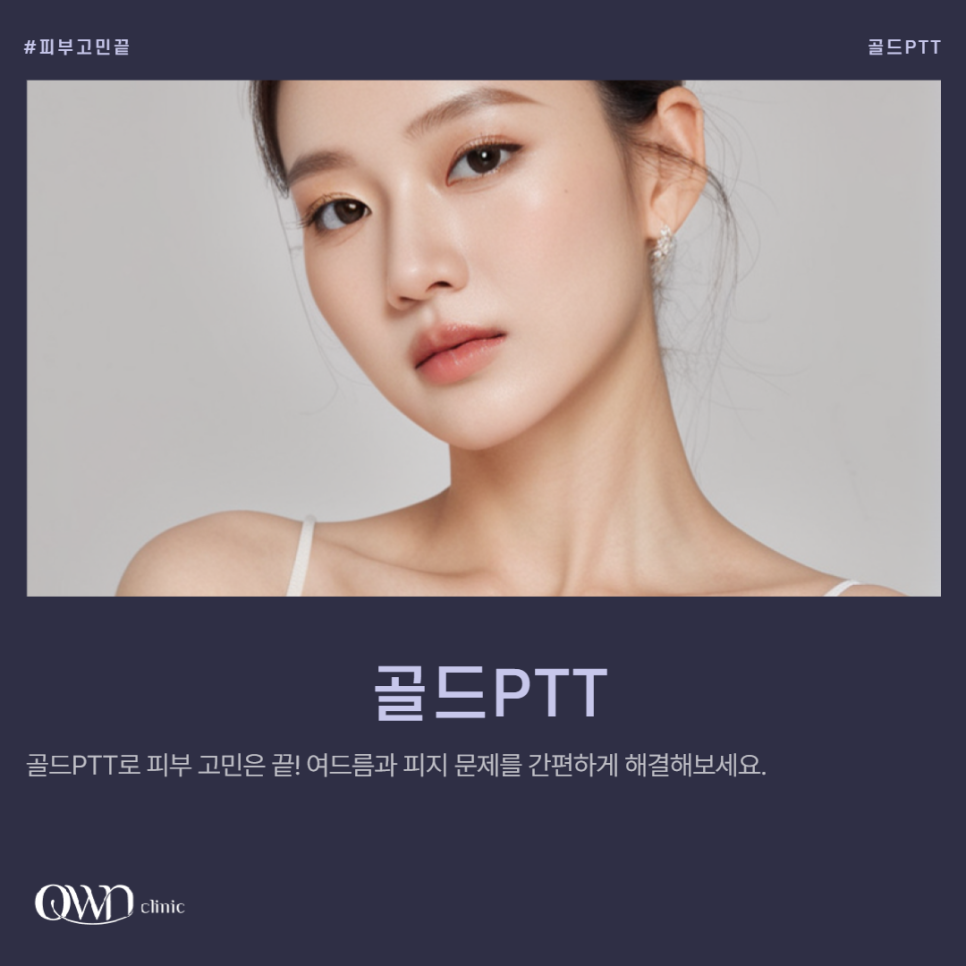 삼성역여드름치료, 지긋지긋한 여드름 고민 홈 케어 만으로는 부족합니다. |  골드PTT 관련 이미지 1